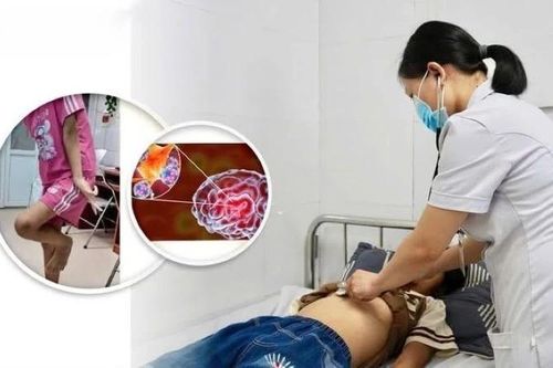 Trẻ 12 tuổi thay đổi hành vi không ngờ do viêm não tự miễn