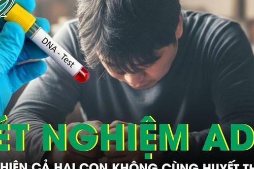 Người đàn ông ngã quỵ khi phát hiện cả hai con không cùng huyết thống sau khi xét nghiệm ADN