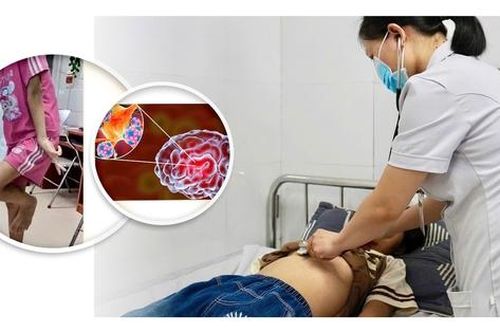 Cứu sống bé gái 12 tuổi bị viêm não tự miễn