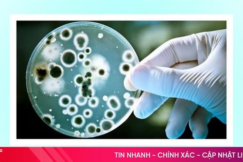 Cảnh báo khẩn về dịch tả có nguy cơ xâm nhập Việt Nam