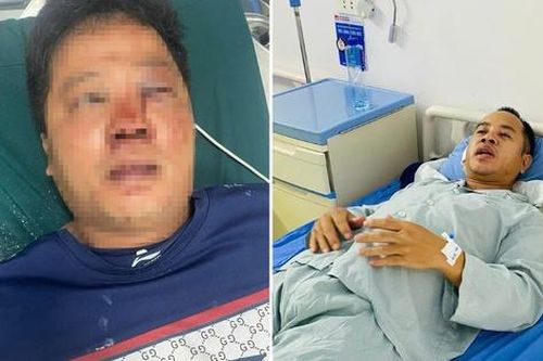 Dừng xe cứu người gặp nạn, hai anh em ở Bắc Ninh bị đánh nhập viện
