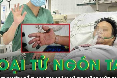 Viêm thuyên tắc mạch máu, loét đầu ngón tay hoại tử vì 30 năm hút thuốc lá