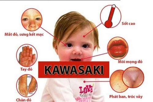 Sốt cao kéo dài, cần cảnh giác bệnh lạ đe dọa tính mạng