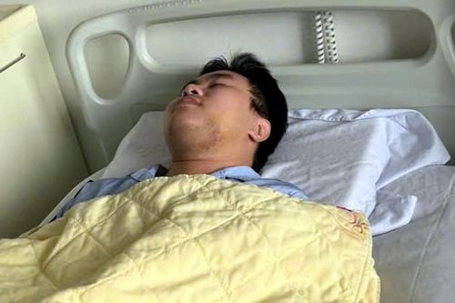 Nam sinh bị đánh gãy xương hàm vì…cho là 'nhìn đểu' giữa phố Hà Nội
