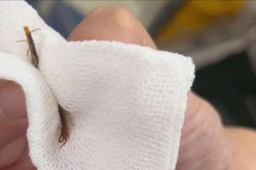 Hy hữu: Con rết dài 5cm chui vào tai người đàn ông đang ngủ