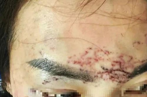 Vụ 2 phụ nữ đánh ghen, đổ axit, xăm mặt người khác ở Cà Mau có diễn biến mới