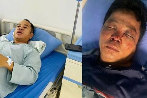 Giúp người bị tai nạn, hai anh em bị hành hung dã man đến nguy kịch