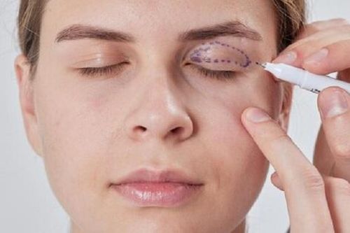 Nhận biết nhược cơ và biến chứng nguy hiểm