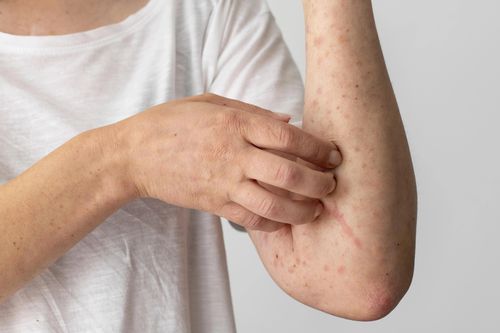 Nhiễm ký sinh trùng gây bệnh gì?