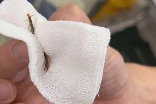 Tai nạn hi hữu: Rết chui vào tai khi đang ngủ