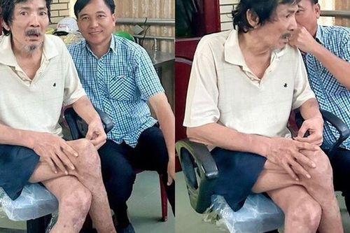 Sao Việt 24h: Thương Tín hiện không thể tự đi lại, vệ sinh cá nhân cần em trai hỗ trợ, di chuyển phải có người dìu