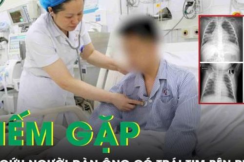 Cấp cứu người đàn ông có trái tim bên phải, phủ tạng đảo ngược hoàn toàn