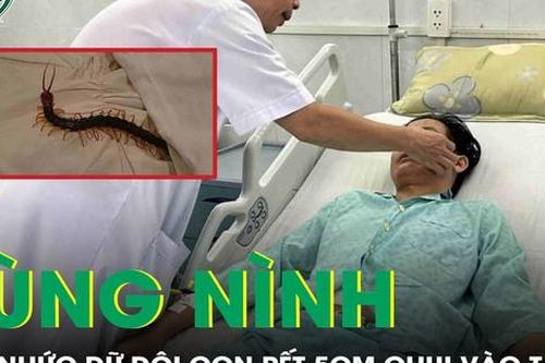 Rùng mình: Con rết 5cm chui vào tai khiến nam công nhân nhập viện trong tình trạng đau nhức dữ dội