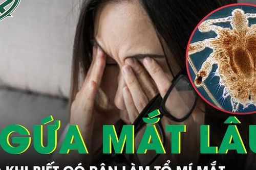 Người phụ nữ Hà Nội sốc khi phát hiện rận ký sinh ngay trên mi mắt