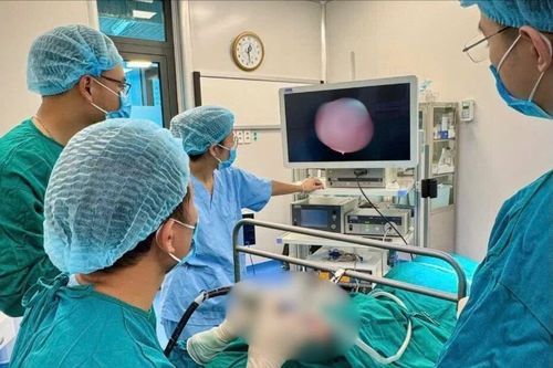 Phát hiện u nang hố lưỡi thanh thiệt khổng lồ ở trẻ sơ sinh