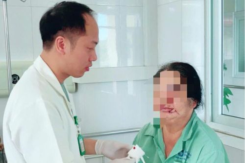 Khối u da bất thường vùng môi dưới không ngờ ung thư