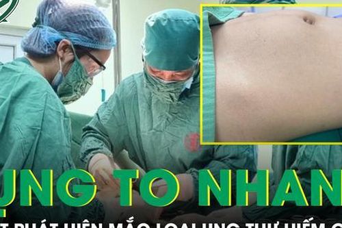 Bé gái 15 tuổi bất ngờ mắc loại ung thư sinh dục hiếm gặp, bụng to nhanh bất thường
