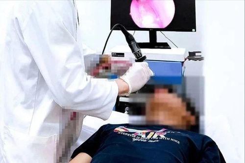 Bệnh nhi 14 tuổi mắc u xơ vòm mũi họng hiếm gặp