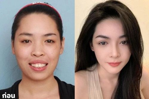 10 năm sau ca phẫu thuật 'đổi đời', Vũ Thanh Quỳnh giờ ra sao?