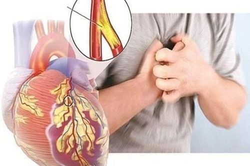 Dấu hiệu âm thầm cảnh báo bệnh tim