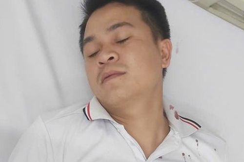 Người đàn ông ở TP.HCM bị người lạ tấn công giữa đường phải nhập viện
