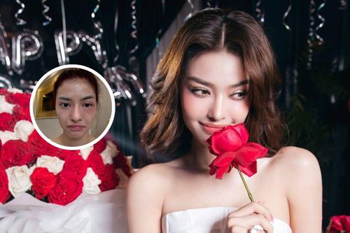 Á hậu Vbiz bị kiến ba khoang cắn, làn da sưng đỏ khiến fan lo lắng