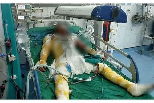 Nhức nhối ở làng nghề Tống Xá - Ninh Bình: Sức khỏe công nhân bị đe dọa, chính quyền xã nói 'chưa nhận được báo cáo'