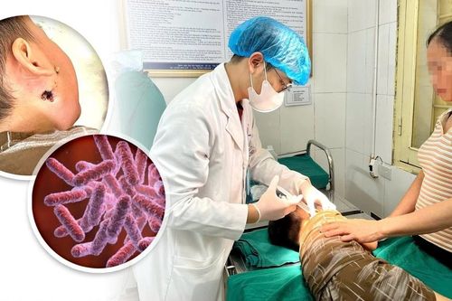 Đau mang tai, sốt cao trẻ 4 tuổi nguy kịch vì vi khuẩn ăn thịt người