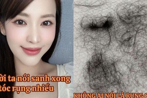 Puka tóc mọc lởm chởm sau khi sinh con đầu lòng, U40 đẻ xong vẫn đẹp rạng rỡ bảo sao Gin Tuấn Kiệt cưng chiều