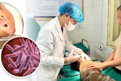 Cứu sống trẻ mắc bệnh Whitmore nguy hiểm