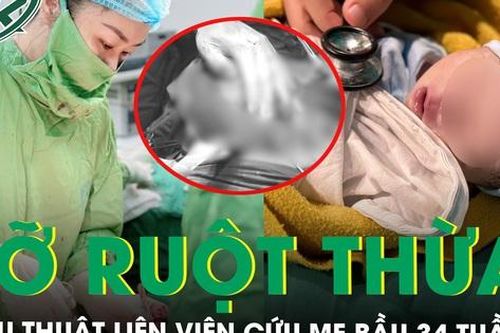 Phẫu thuật liên viện cứu mẹ bầu 34 tuần vỡ ruột thừa nguy hiểm