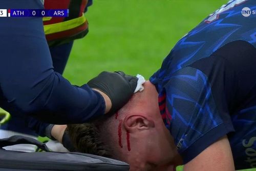 Tân binh đắt giá đổ máu, Arsenal thắng trận ra quân Champions League