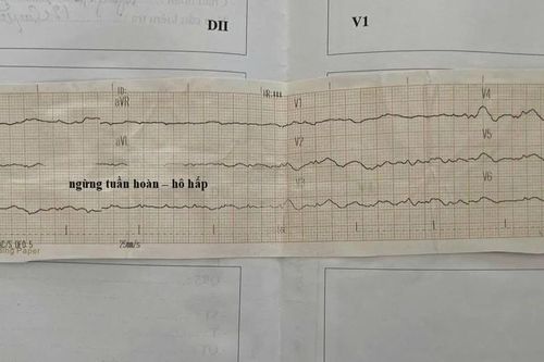 Cứu sống nữ sinh 18 tuổi ngưng tim sau cuộc thi bơi ở trường về