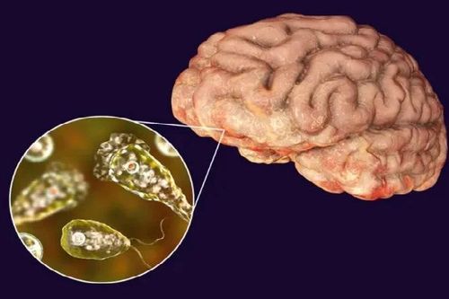 Gia tăng số ca nhiễm 'amip ăn não' gây tử vong tại bang Kerala (Ấn Độ)