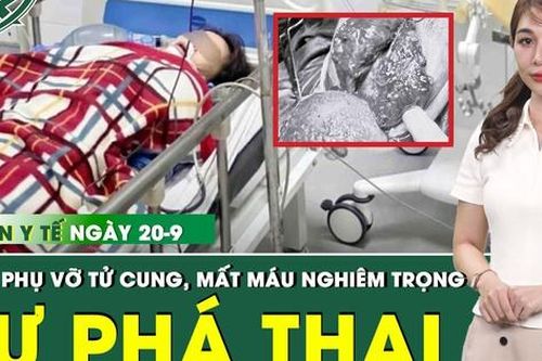 Bản tin Y tế 20/9: Tự phá thai 33 tuần, sản phụ nguy kịch, vỡ tử cung