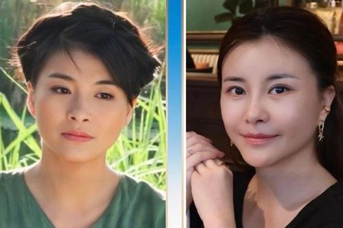 NSƯT Kim Oanh trẻ đẹp ngỡ ngàng sau phẫu thuật thẩm mỹ