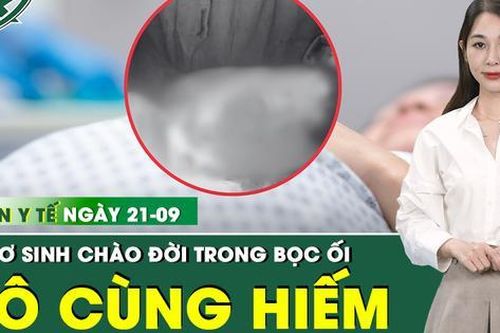Bản tin Y tế 21/9: Bé sơ sinh chào đời vẫn còn nguyên trong bọc ối