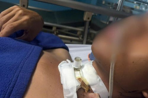 Quảng Trị: Cấp cứu bệnh nhân bị đứt khí quản do vướng dây điện khi đi đường