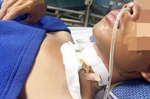 Quảng Trị: Cứu sống bệnh nhân bị đứt khí quản do vướng dây điện thoại sà giữa đường