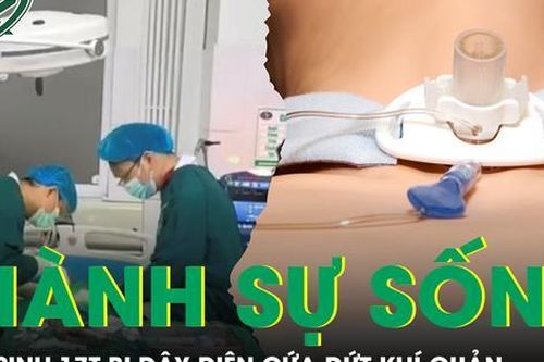 3 giờ giành lại sự sống cho nam sinh 17 tuổi bị dây điện cứa đứt khí quản