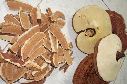 8 bài thuốc đơn giản chữa thiếu máu não mạn tính
