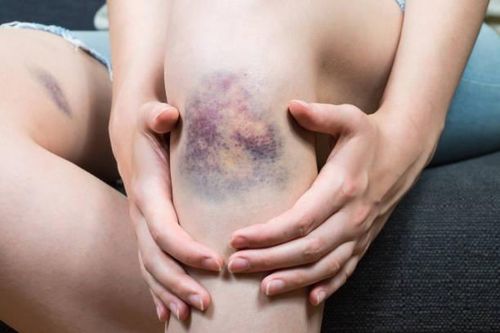 Dấu hiệu cơ thể cảnh báo nóng gan