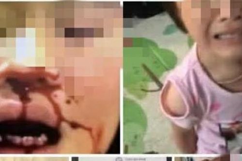 Vụ bé gái nghi bị bố bạo hành, bắt gọi mẹ 'gửi tiền về': Kết quả xác minh từ chính quyền