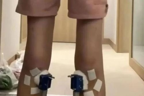Thiếu niên chi 2.350 USD để cao thêm 1,4 cm, nhưng 'mất sạch' chỉ sau 2 tuần
