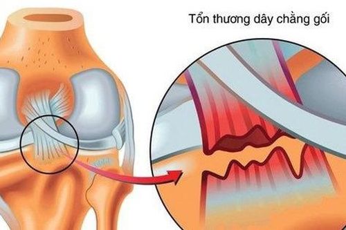Rách dây chằng có liền lại không?