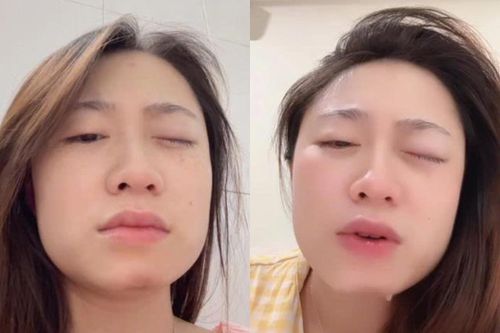 TikToker 'Ngọc Khánh đây' bị rách giác mạc khi chơi cùng con