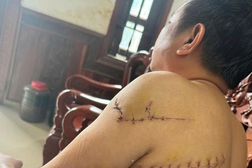Đồng Nai: Mở rộng điều tra vụ truy sát dã man giữa ban ngày