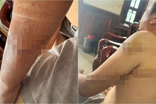 Bắt giữ 3 nghi phạm truy sát người đàn ông ở Đồng Nai