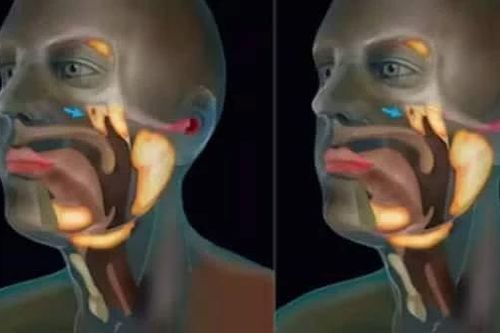 Phát hiện cơ quan mới trong cơ thể người
