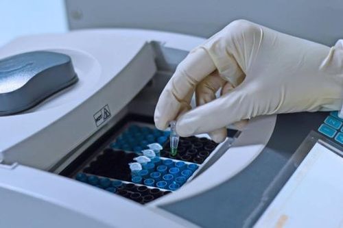 Đột biến CFAP65 khiến tinh trùng bất động